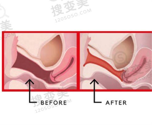 重庆松山医院正颌肖林医生患者评价如何?技术优价格合理获众多好评之患者真实评价
