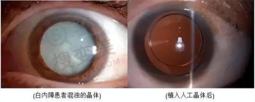 重庆松山医院磨骨医生牛!朱乐林技术强成效好,口碑佳