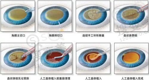 重庆松山口腔科最厉害三个医生，肖林等正颌磨骨技术优、收费合理易预约 