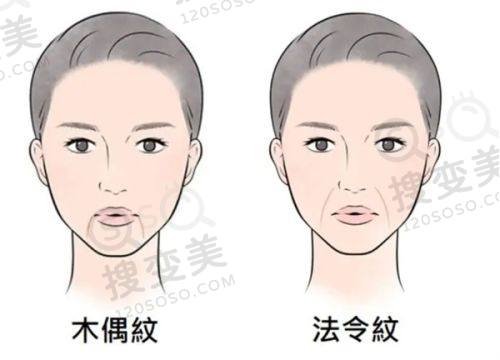 重庆松山医院简介:私立正规有3级资质,正颌磨骨技术优口碑好可预约——正颌手术优势