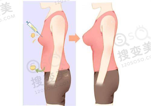 重庆松山医院整形科是公立还是私立？私立3级医院正颌磨骨技术优口碑好可约 