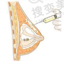 重庆松山医院眼科怎么样?秦伟医生临床成果彰显技术优,口碑好