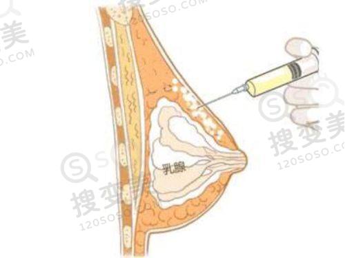 重庆松山医院磨骨怎么样?挂号便捷让患者轻松就医