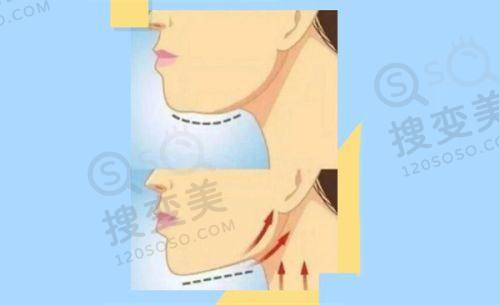 重庆松山医院整形科怎么样？收费合理，让患者明明白白消费