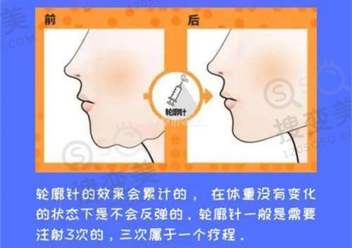 重庆松山医院口腔科医生怎么样？肖林正颌技术强价格亲民口碑好，多案例见证效果