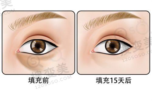重庆松山眼科医院官网公布!专精眼科诊疗,口碑良好,在线预约挂号超便捷——医院综合实力与服务优势