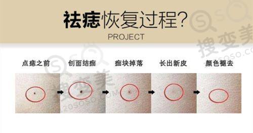 重庆松山医院整形科李凤医生简介：正颌技术实力强