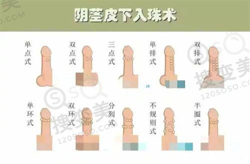 重庆肖林磨骨多少钱?松山医院医生正颌磨骨技术优势