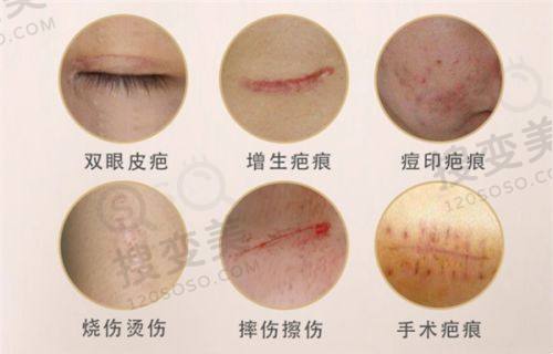 重庆松山医院是国有么？是私立但特别正规且正颌手术技术好——王涛医生正颌手术技术