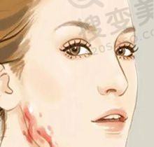 重庆松山整形医院是正规医院吗？医生技术强口碑好，正颌等四级手术资质在手