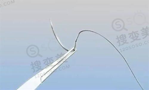 南京施尔美整形医院价格表曝光!多项目收费透明,医生技术优口碑好