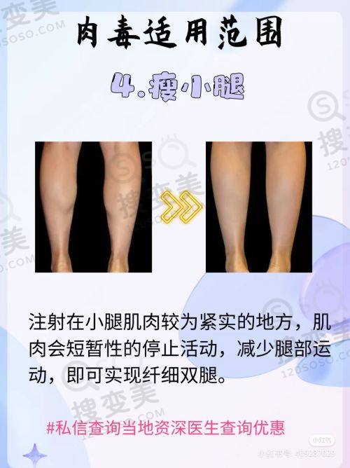 重庆松山肖林做正颌怎么样？20年经验3D导航，5万起价顾客好评多