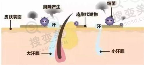 重庆松山医院磨骨手术费用是多少？肖林磨骨低至3.8万，预约快成效惊艳 