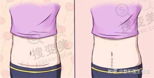 重庆松山整形医院朱乐林医生手术失败是假,磨骨成效好口碑高无事故之技术优势