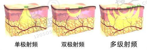 重庆松山医院整形科怎么样?服务贴心周到
