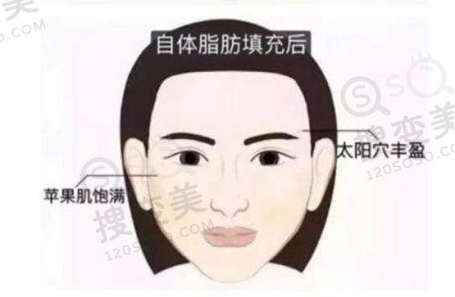重庆松山医院徐铎双眼皮怎么样？擅长多领域整形，技术优口碑好之腹壁手术表现