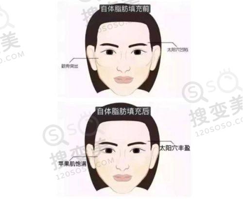重庆松山医院官网网上挂号预约攻略：多渠道预约享便捷，肖林磨骨正颌有保障 