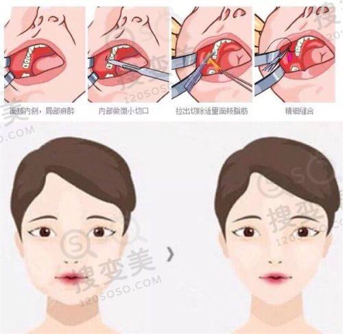 重庆松山口腔医院怎么样？医生技术强、口碑好，正畸正颌成效自然满意度高——正畸正颌技术魅力展现