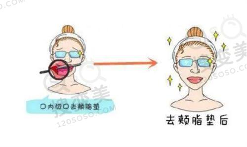 重庆松山医院整形外科电话是多少？徐铎医生预约方式全揭秘