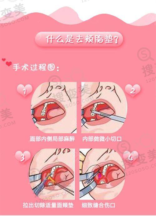 重庆松山医院怎么样?看了做正颌手术的牙友口碑都说正规又好——收费情况