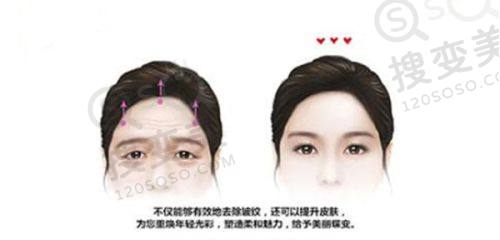 重庆松山医院磨骨价格揭秘!夏德林经验多技术优成效好