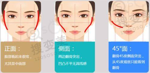 重庆松山医院正颌手术王涛和肖林哪个更好?技术优势之王涛医生