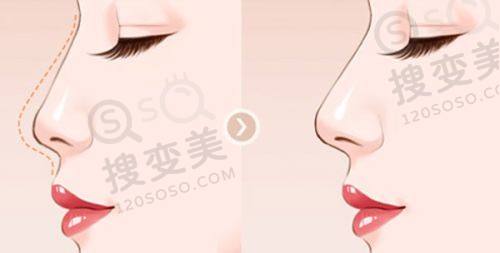 重庆松山口腔医院怎么样?正畸正颌技术出色成效优