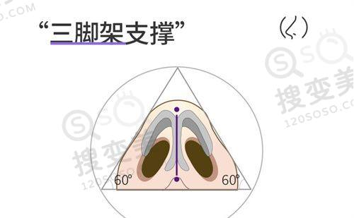 重庆松山医院双眼皮修复费用是多少？段艳军修复技术优收费合理——技术特色保护修复成效