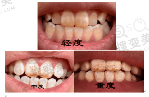 4、十八颗美牙口腔门诊部特色项目及技术优势