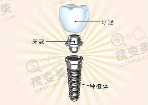 9、陕西贝齿乐口腔医院真人口碑评价怎么样？