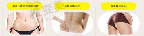 泉州做埋线双眼皮多少钱?海峡/欧菲等医院收费实惠效果好
