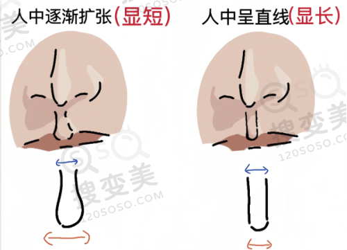 硅胶假耳朵要多少钱?其他义耳价格对比