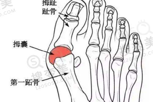 泉州隆胸医院排名前十强，海峡/美莱华美等口碑佳技术好效果优 