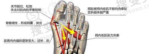 韩国热玛吉多少钱?按疗程次数划分的收费情况