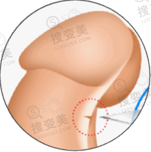 泉州脂肪填充哪家好——综合对比与选择建议