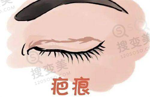 SMAS面部提升技术及价格综合分析