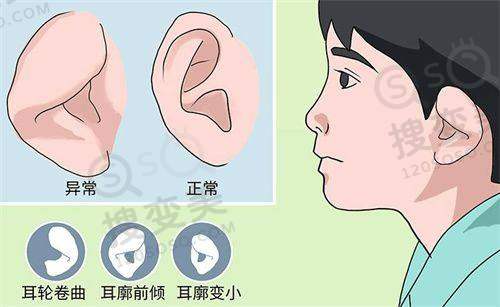 泉州做埋线双眼皮多少钱:影响价格的因素