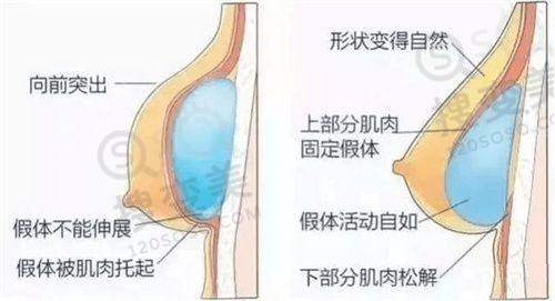 韩国热玛吉多少钱?韩国热玛吉的功效优势
