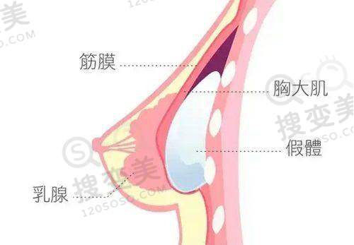 【真相】林潮割双眼皮价格是多少钱——林潮医生技术实力与价格的关系