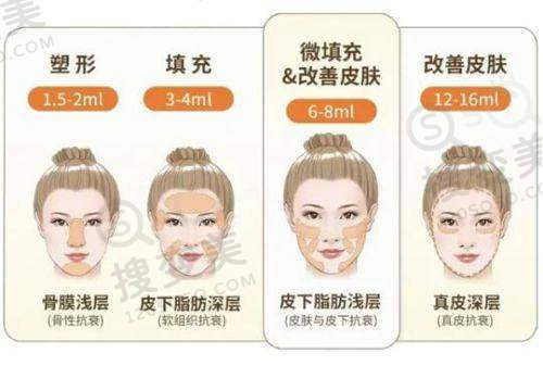 热玛吉五代全脸做一次多少钱?2025成都/杭州/上海多地价格揭秘