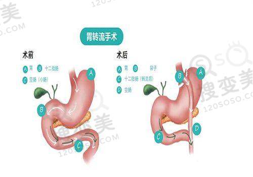 悦龄塑价格多少钱一针:与其他填充材料价格对比