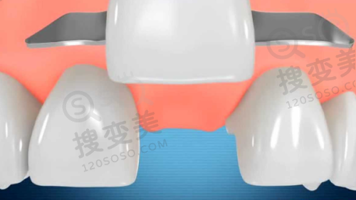 8、厦门登特口腔医院详细的预约挂号方式及流程