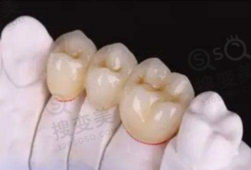 2、绍兴越城口腔医院是正规医院吗?