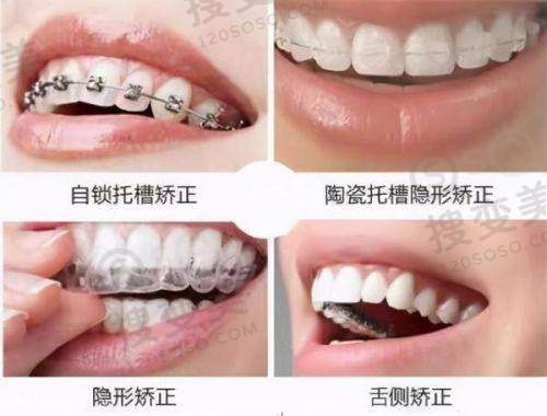 4、济宁美雅口腔诊所特色项目及技术优势