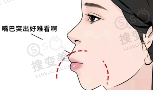 4、东莞蒙恩口腔门诊部特色项目及技术优势