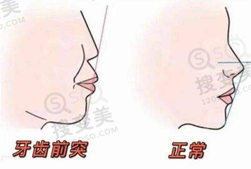 4、北京博尔口腔门诊部特色项目及技术优势