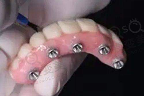 2、北京美冠塔口腔医院是正规医院吗?