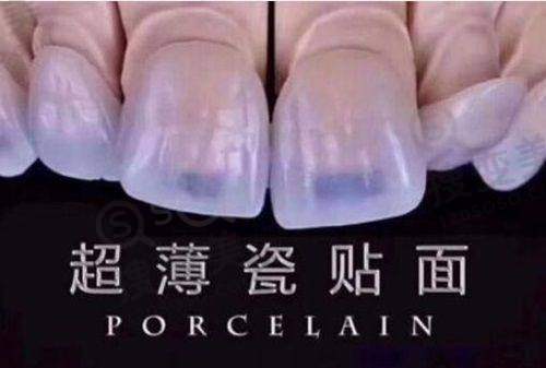 9、绍兴越城口腔医院真人口碑评价怎么样?