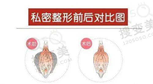 成都艾米丽整形价格表更新之医院优势