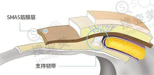 泉州面部吸脂好的医院汇总——医院技术与价格对比